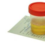 Uriini ja vere uurimine metanefriinide jaoks Kuidas annetada uriini metanefriinide jaoks