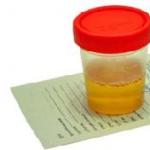 Proteinuuria või valk uriinis neerupatoloogia tunnusena